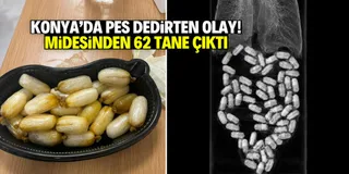 Konya'da pes dedirten olay: Midesinden 62 tane çıktı!