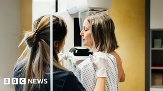 Millions of breast cancer patients could safely avoid chemotherapy, study suggests